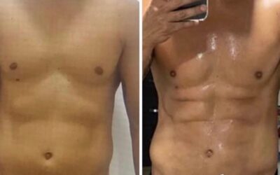 Slim laser