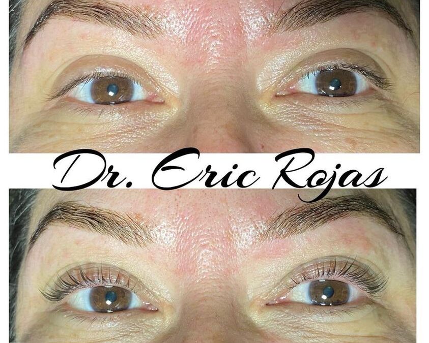 Lifting de pestañas