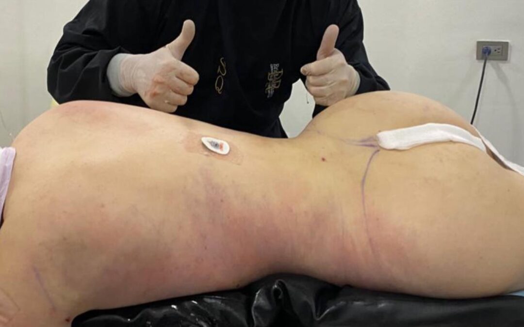 SLIM LÁSER CAMBIA TU CUERPO CAMBIA TU VIDA 22483535