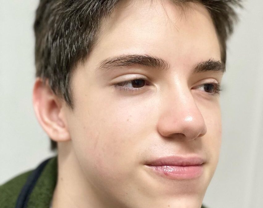 ROSTROS LIBRES DE ACNÉ