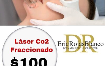 Láser Co2 fraccionado