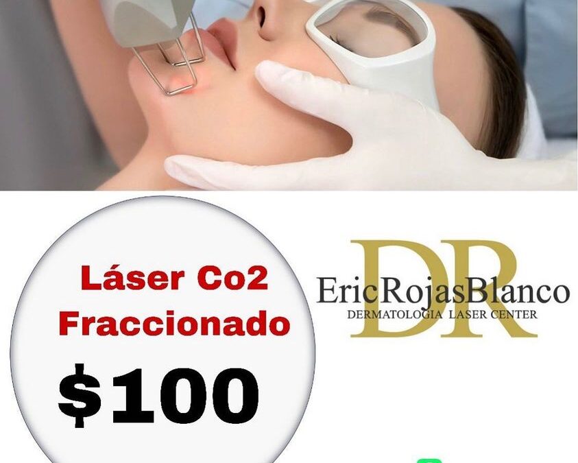 Láser Co2 fraccionado