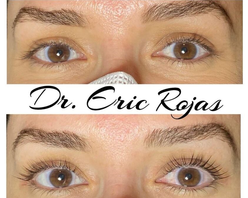 Lifting de Pestañas