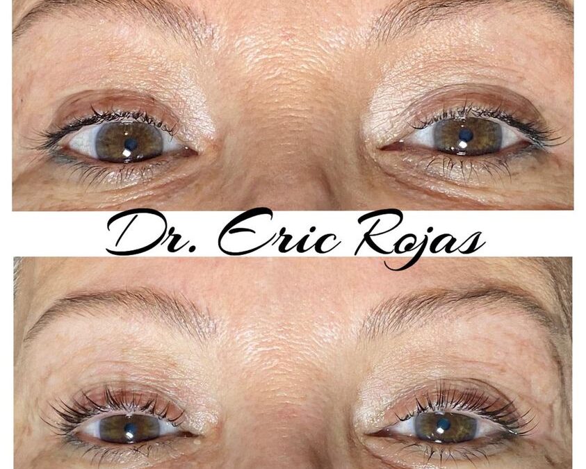 Si buscas lucir unas pestañas rizadas y muy naturales quizá debes probar un lifting de pestañas.