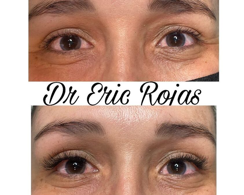 Extensiones de pestañas