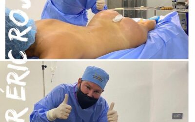 Slim laser, tenemos el mejor equipo quirúrgico
