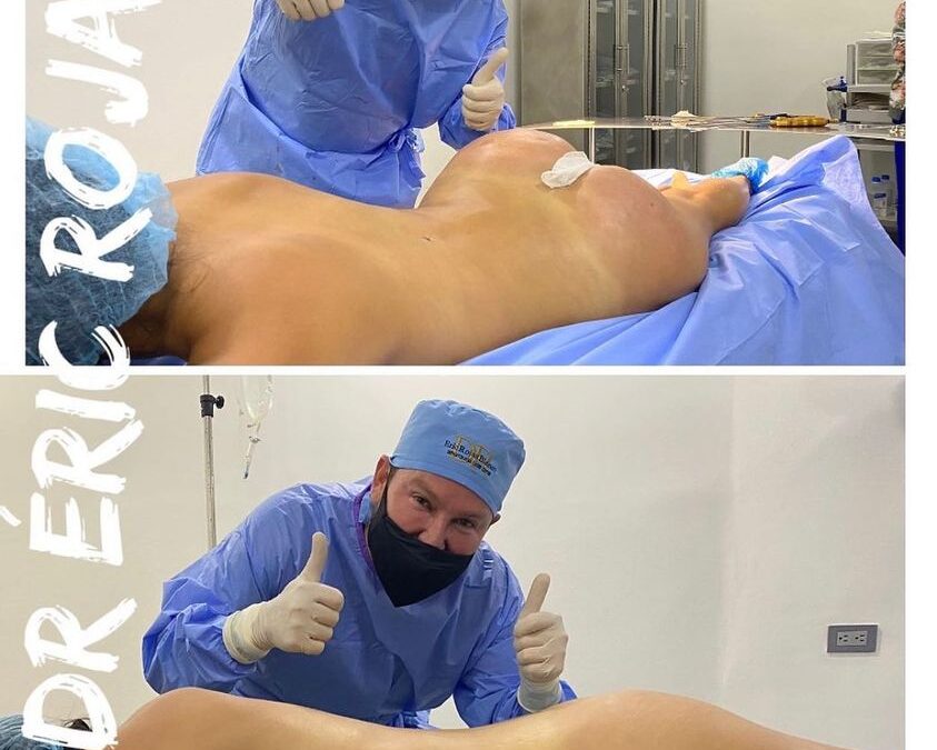 Slim laser, tenemos el mejor equipo quirúrgico