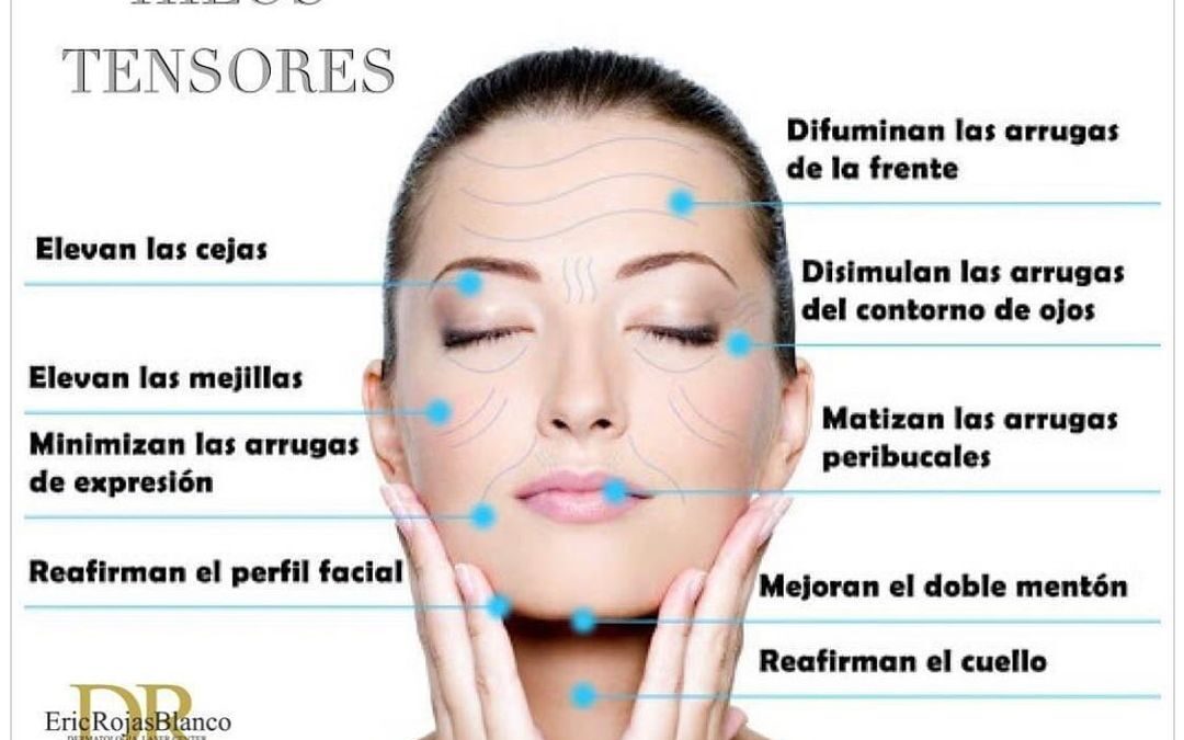 Hilos mágicos o hilos tensores?