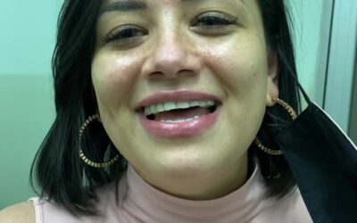 Pacientes de ACNÉ FELICES DE TENES SU CARA LIMPIA