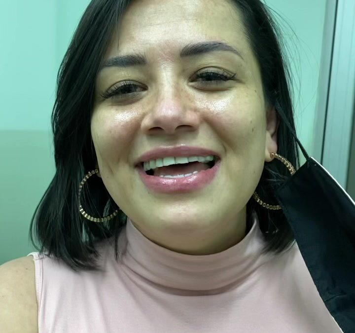 Pacientes de ACNÉ FELICES DE TENES SU CARA LIMPIA