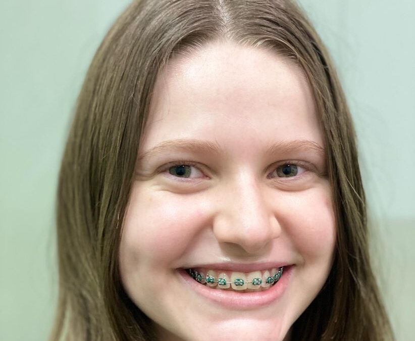 Rostros LIBRES DE ACNÉ CON EL DR ÉRIC ROJAS 22483535