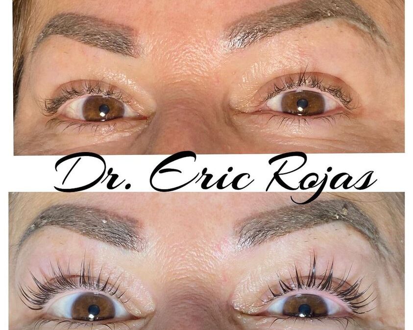 Lifting de pestañas