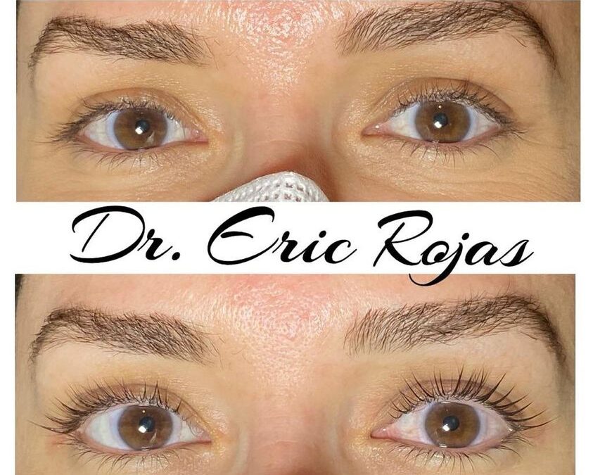 Lifting de Pestañas