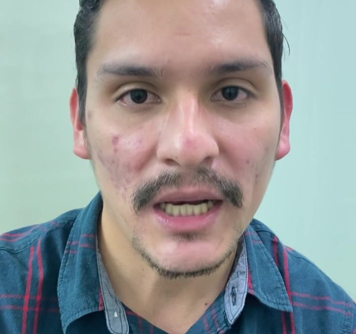 Testimonios reales PACIENTES LIBRES DE ACNÉ