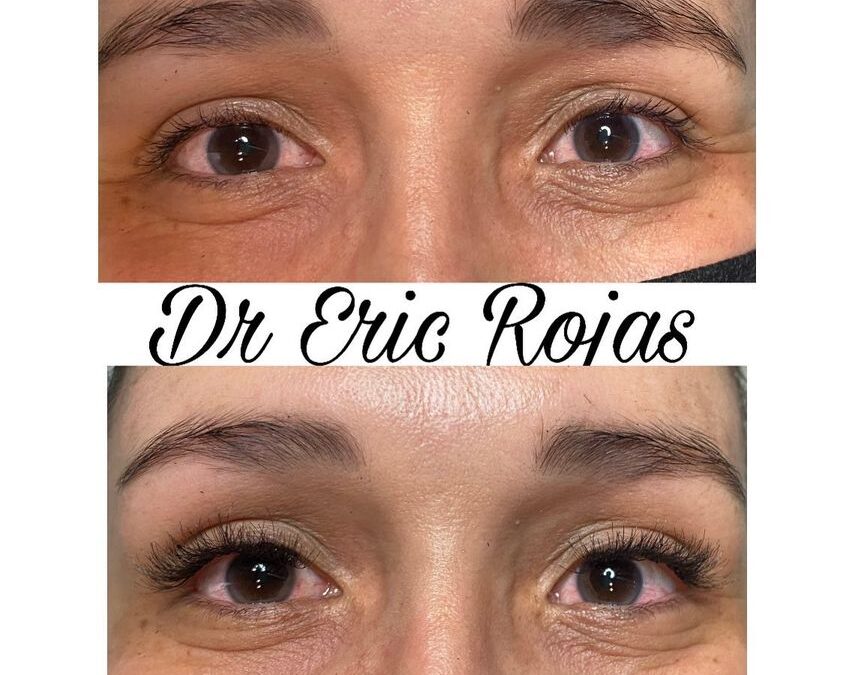 Extensión de pestañas