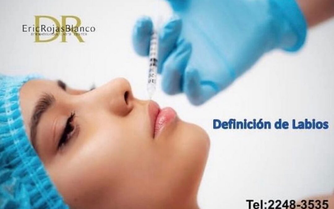 Definición de labios