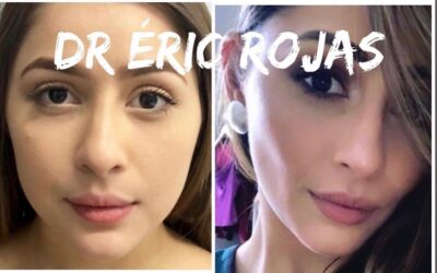 Perfilado Facial
