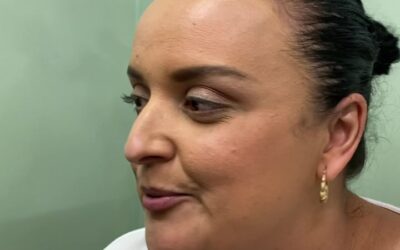 ACIENTES EN TRATAMIENTO DE ACNE