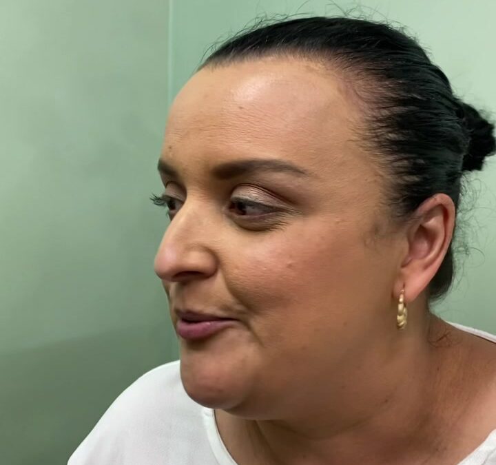 ACIENTES EN TRATAMIENTO DE ACNE