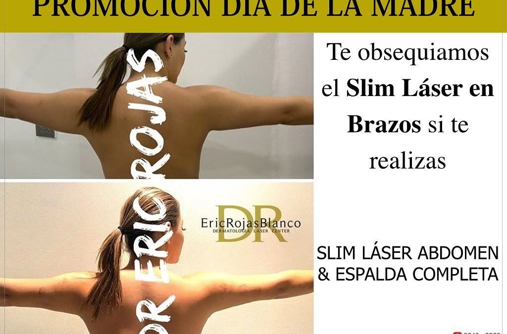 Promoción del día de la madre