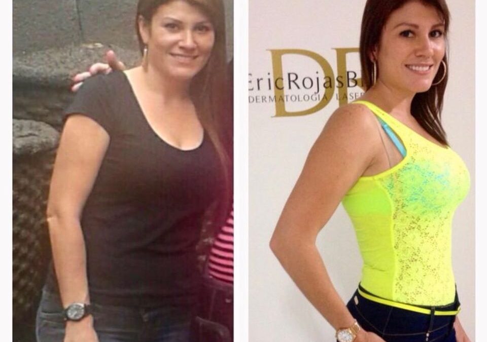 SLIM Láser DR ÉRIC ROJAS