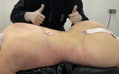 Slim laser