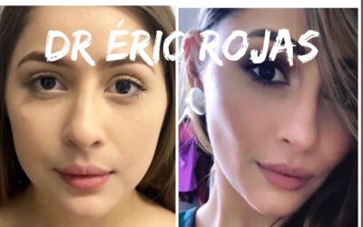 Perfilado FACIAL