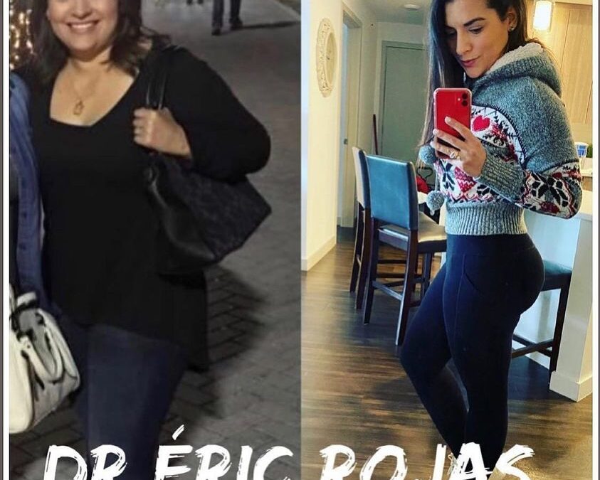 Slim laser contamos con el mejor equipo