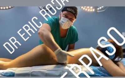 Resultados como este, sólo con SLIM LÁSER, exclusivo del Dr. Eric Rojas Blanco