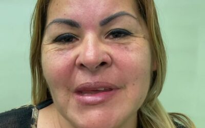 Testimonios REALES PACIENTES REALES