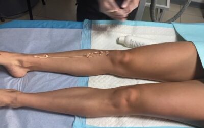 Depilación láser sin dolor!!