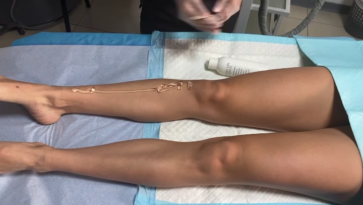 Depilación láser sin dolor!!