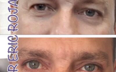 Refresca tu mirada Dr Eric Rojas