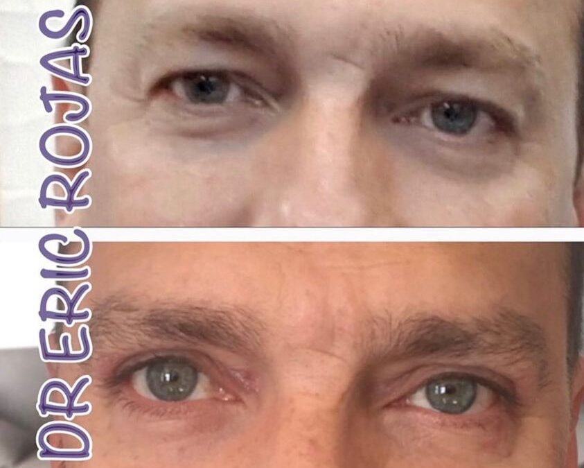 Refresca tu mirada Dr Eric Rojas