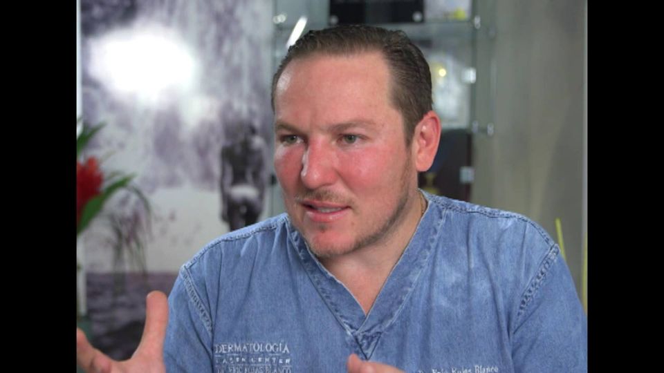 El acné tiene cura…