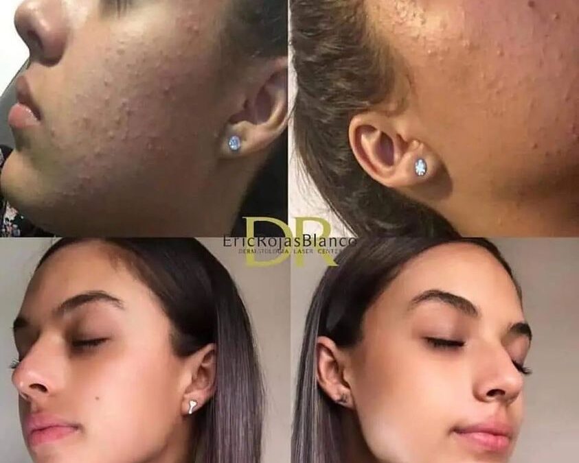 Su rostro en manos del Dr. Eric Rojas