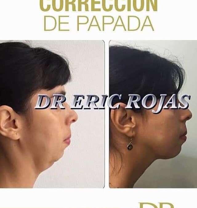 Excelentes resultados