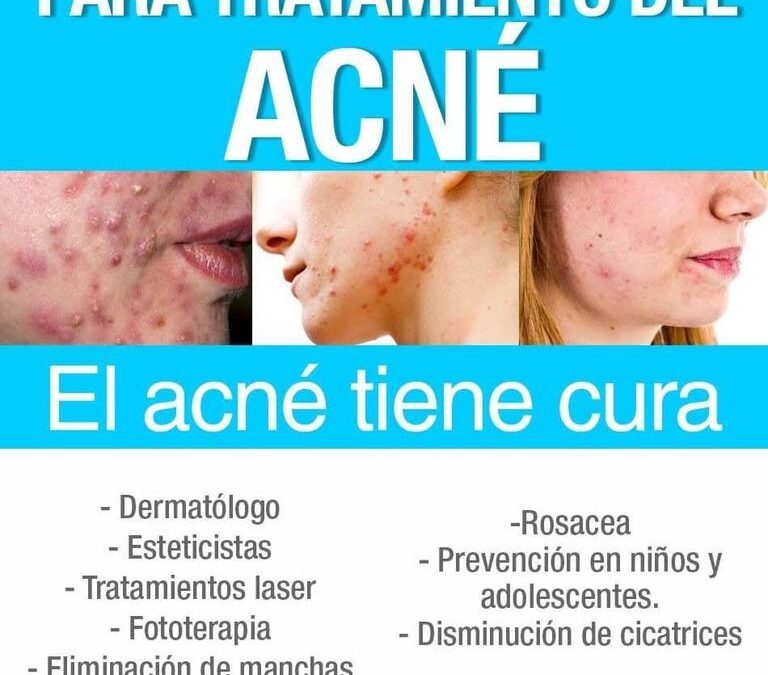 Tenemos la solución