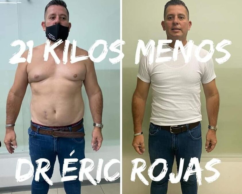 21 kilos menos es posible con el Dr. Eric Rojas