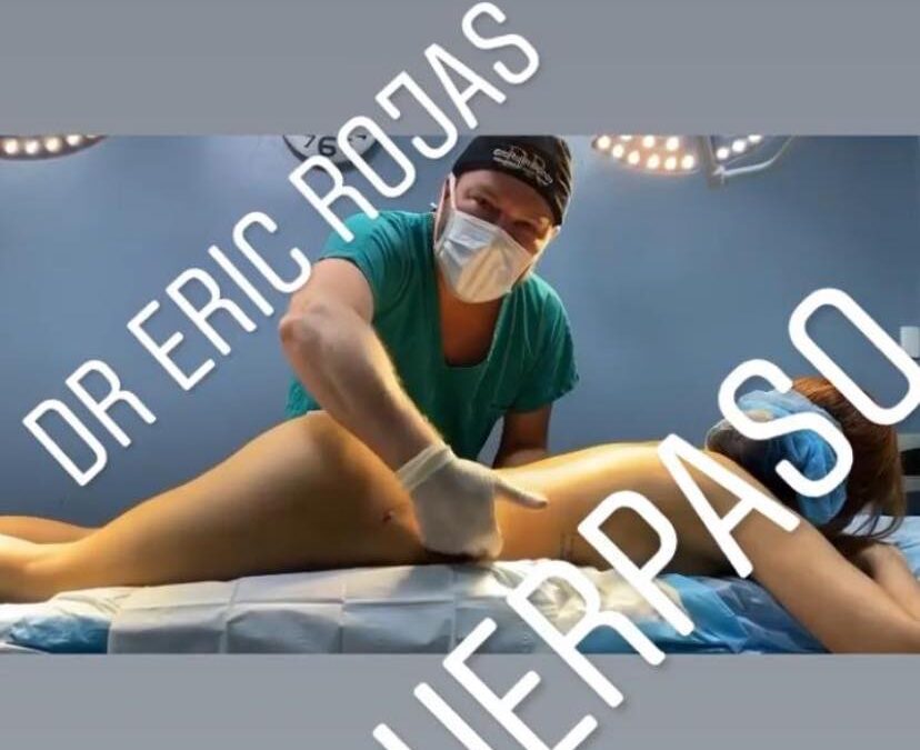 Resultados como este, sólo con SLIM LÁSER