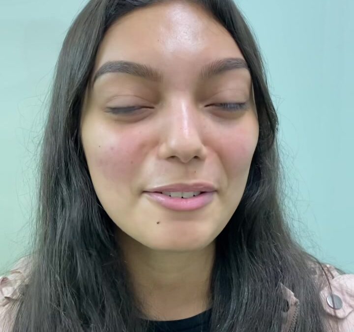 Pacientes FELICES DR ERIC ROJAS 22483535