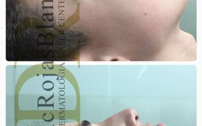 Excelentes resultados en manos del Dr Eric Rojas