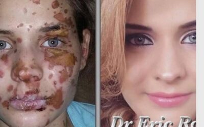 Increíbles resultados con los tratamientos del Dr. Eric Rojas
