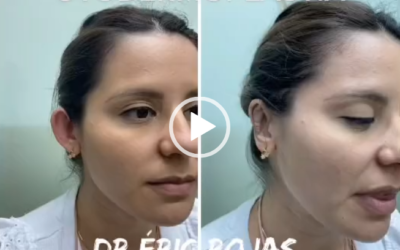 Ortodermoplastia