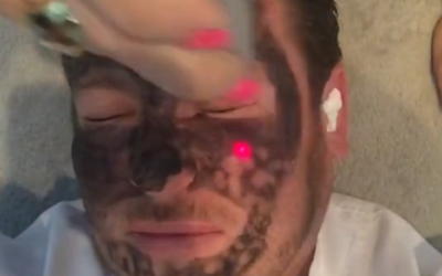 Black Peel