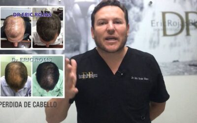Pérdida de cabello, llámanos hoy mismo para una cita.