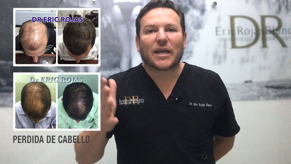 Pérdida de cabello, llámanos hoy mismo para una cita.