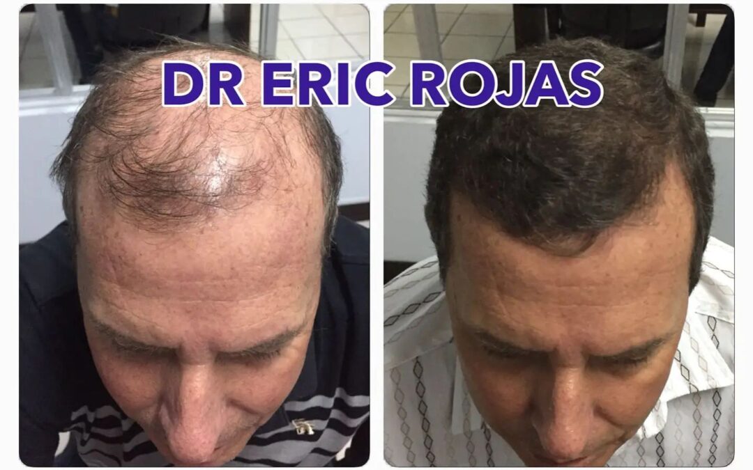 Tenemos la solución