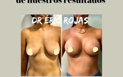 Resultados Dr. Eric Rojas