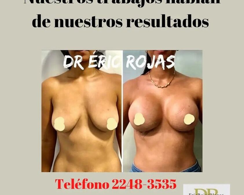 Resultados Dr. Eric Rojas